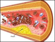 Sindromul metabolic