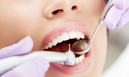 A kezelési módszerek a fogszuvasodás nélkül fúró ózon, a levegő, a fluoreszcencia
