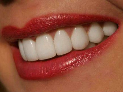 Metode de tratare a cariilor dentare fără ozon, aer, fluorescență