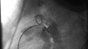 Deschis duct arterial la câini