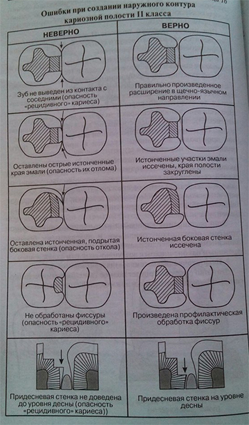 Препарування каріозних порожнин