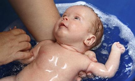 Az okok a korpásodás az újszülött, és hogyan lehet tőle megszabadulni (ok) Az okok a korpásodás az újszülött, és hogyan lehet tőle megszabadulni
