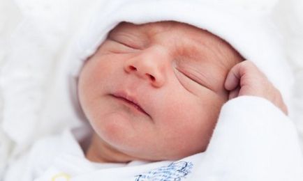 Причини виникнення лупи у новонародженого і способи позбавлення від неї