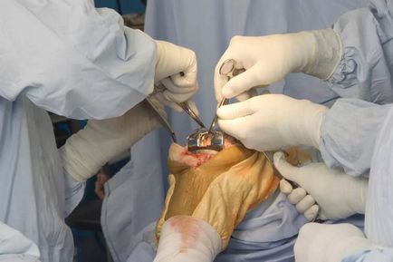 Протезування суглобів в «центрі спортивної травми», операції з ендопротезування за доступними