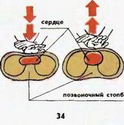 Серцево-легенева реанімація штучне дихання і масаж серця, надання першої медичної