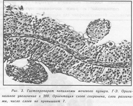 Examinarea citologică a urinei (cyme), (m