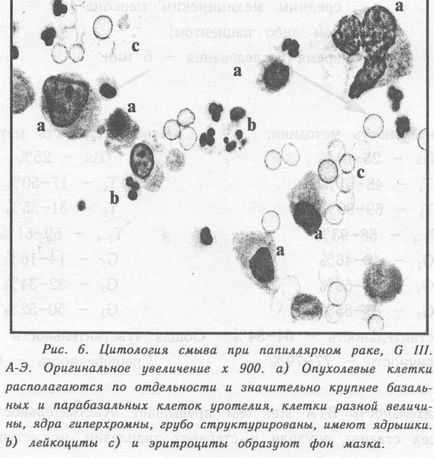 Стаття цитологічне дослідження сечі (ЦІМ), (м