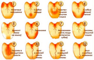 Structura limbii umane (fotografie) indicată de culoarea rădăcinii și a spatelui acestui organ