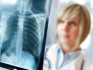 Туберкульоз легень - перші симптоми у дорослих, наслідки
