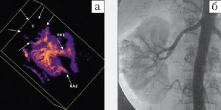 Angiografia ultrasonică ca metodă de diagnosticare a patologiei vasculare