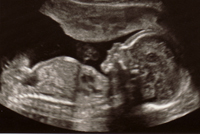 Imagine ultrasunete sau certificat de cea mai veche viață