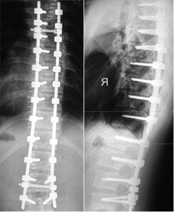 Uzi, mrt sau x-ray ce să aleagă