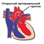 Cardiologia veterinară deschide canalul arterial la mamifere - Donetsk veterinar