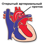 Ветеринарна кардіологія відкрита артеріальна протока у ссавців - донецький ветеринарний