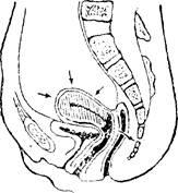 Organele sexuale interne ale femeii sunt stadopedia