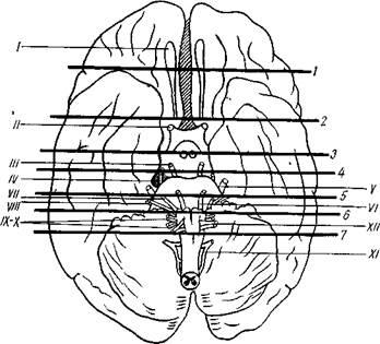 Autopsia creierului