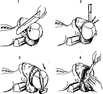 Розтин порожнини черепа і витяг головного мозку