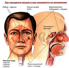 Betegségek, a fül-orr-gégészeti