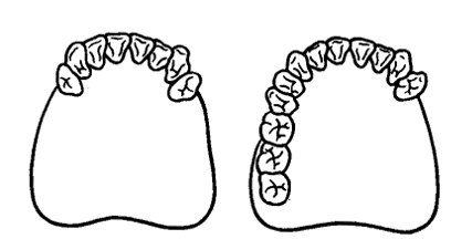 Ceramica 8F pe oxid de zirconiu