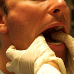 Anestezia la nivelul maxilarului, indicații contraindicaționale și metode de bază pentru efectuarea