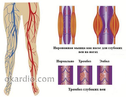 Inflamații venoase asupra simptomelor picioarelor, ce trebuie făcut, boli posibile, prognostic
