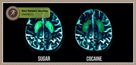 Чим шкідливий цукор для організму дітей і дорослих