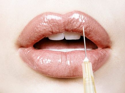 Ce trebuie să știți despre augmentarea buzelor