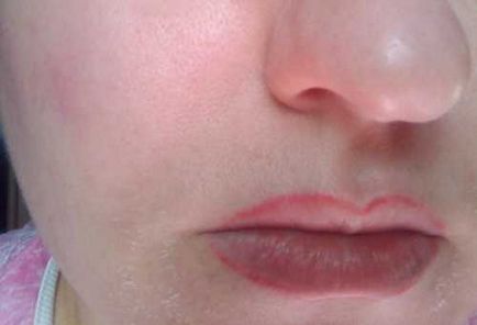 Desheli, lánc szépségszalonok - allergiát okozhatnak! (Fotó arc után) - Vélemények