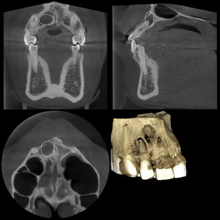 Cone-beam komputertomográfia - Dental Clinic SAD