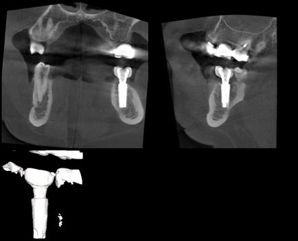 Cone-beam komputertomográfia - Dental Clinic SAD