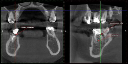 Cone-beam komputertomográfia - Dental Clinic SAD