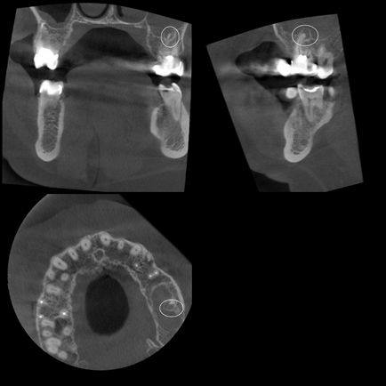 Cone-beam komputertomográfia - Dental Clinic SAD