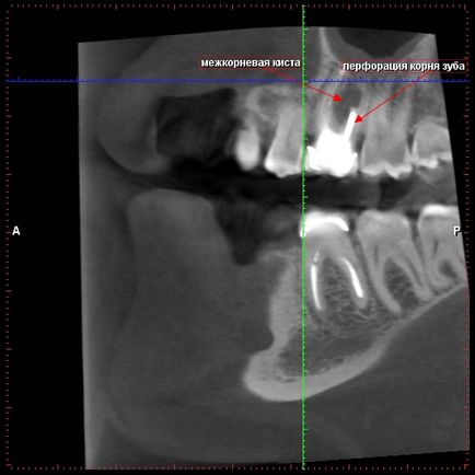 Cone-beam komputertomográfia - Dental Clinic SAD