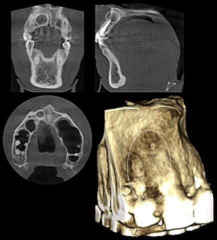 Cone-beam komputertomográfia - Dental Clinic SAD