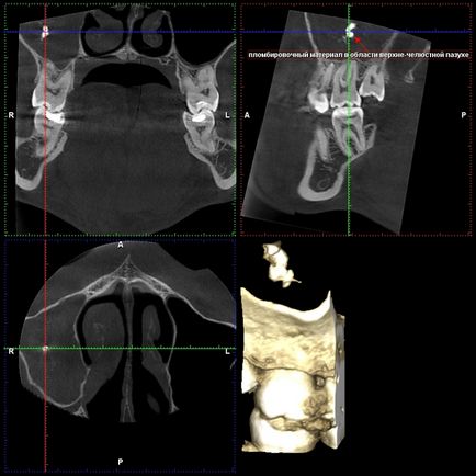 Cone-beam komputertomográfia - Dental Clinic SAD