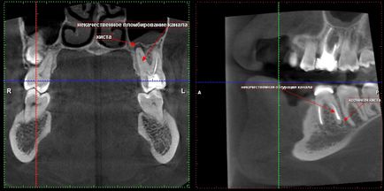 Cone-beam komputertomográfia - Dental Clinic SAD
