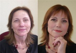 Lifting-make-up rezolvă probleme fără operațiuni