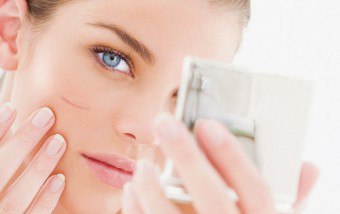 Мазь від шрамів і рубців на обличчі - лікування рубців