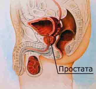 Metode și remedii populare pentru tratamentul prostatitei