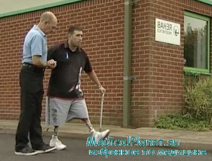 Instruirea privind mersul pe proteze după amputarea coapsei și piciorului inferior, opriți