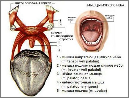 Pareza palatului moale