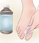 Перекис водню проти грибка нігтів на ногах - чи допомагає, чи можна вилікувати і як