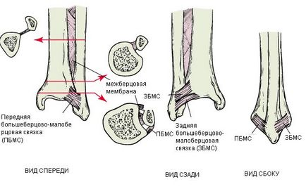 Fracturile gleznelor - acuarelă clinică chirurgie plastică