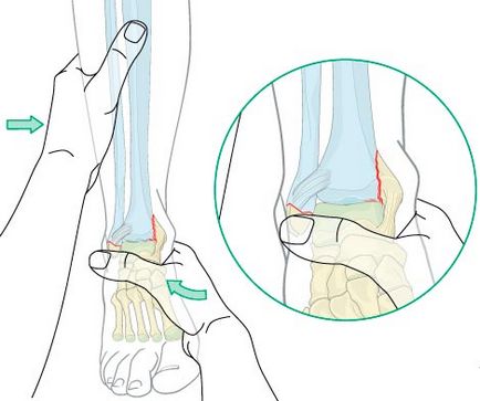 Переломи кісточок - клініка пластичної хірургії акварель
