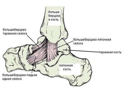 Fracturile gleznelor - acuarelă clinică chirurgie plastică