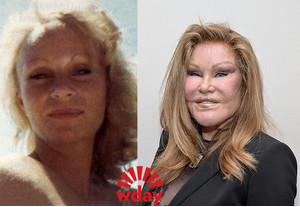 Operațiunile din plastic ale vedetelor înainte și după fotografie - ziua femeii