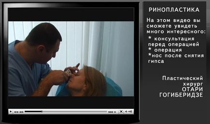 Chirurg plastic gogiberidze Otari teymurazovich - un clasament de chirurgi plasticieni, comentarii despre