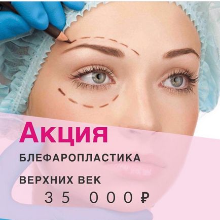 Chirurgie plastica la Moscova - clinica de chirurgie plastica