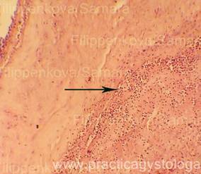 Placental - o practică a unui histolog