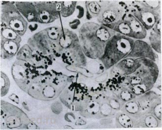 Pancreas - sisteme corporale (histologie)